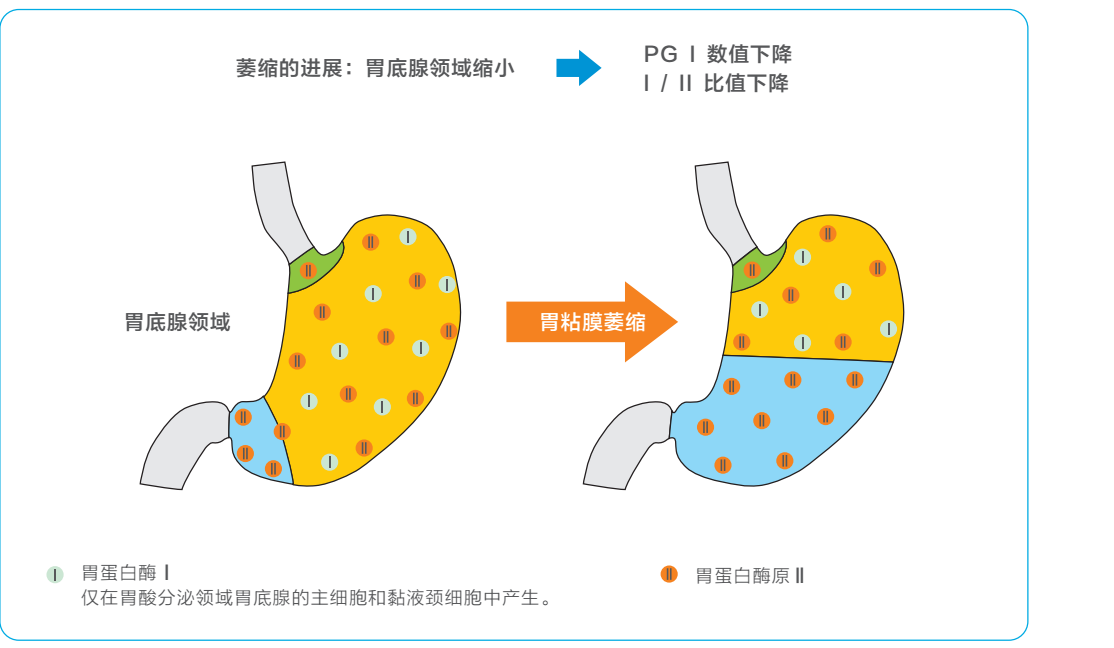 胃镜检查出的胃粘膜萎缩与胃蛋白酶原检测的数值